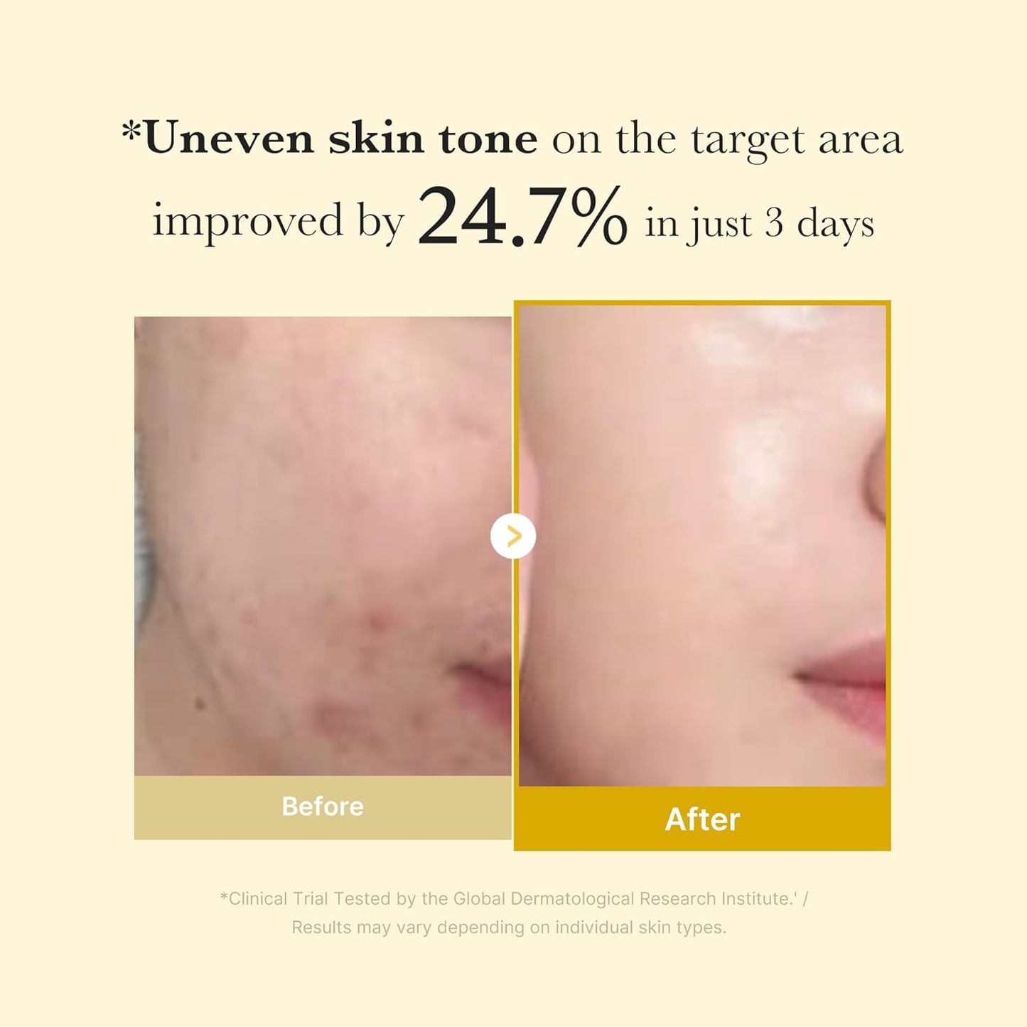 Kojic Turmeric Night Mask – Dark Spots & Hyperpigmentation Repair